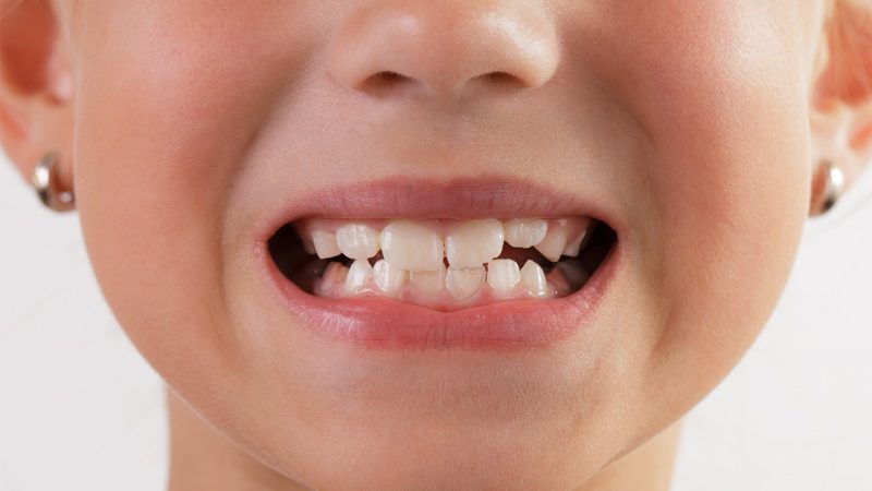 teeth